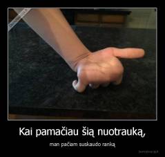 Kai pamačiau šią nuotrauką, - man pačiam suskaudo ranką