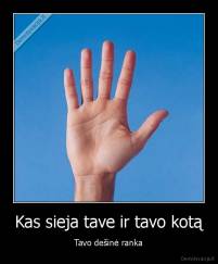Kas sieja tave ir tavo kotą - Tavo dešinė ranka