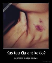 Kas tau čia ant kaklo? - Ai, mama rūgštim apipylė