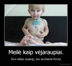 Meilė kaip vėjaraupiai. - Kuo vėliau susergi, tuo sunkesnė forma