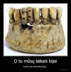 O tu mūsų laikais bijai - nueiti pas stomatologą...
