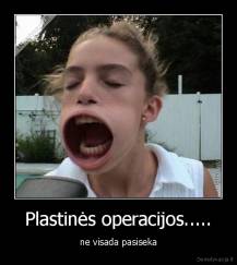 Plastinės operacijos..... - ne visada pasiseka