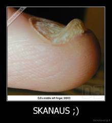 SKANAUS ;) - 