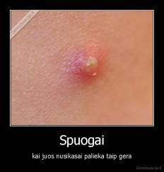 Spuogai - kai juos nusikasai palieka taip gera