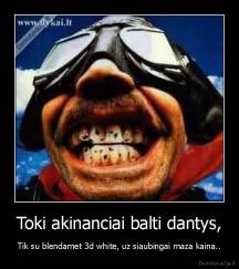 Toki akinanciai balti dantys, - Tik su blendamet 3d white, uz siaubingai maza kaina..