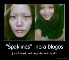 "Špaklinės"  nėra blogos - jos rūpinasi, kad negautume infarkto