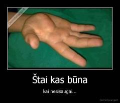 Štai kas būna - kai nesisaugai...